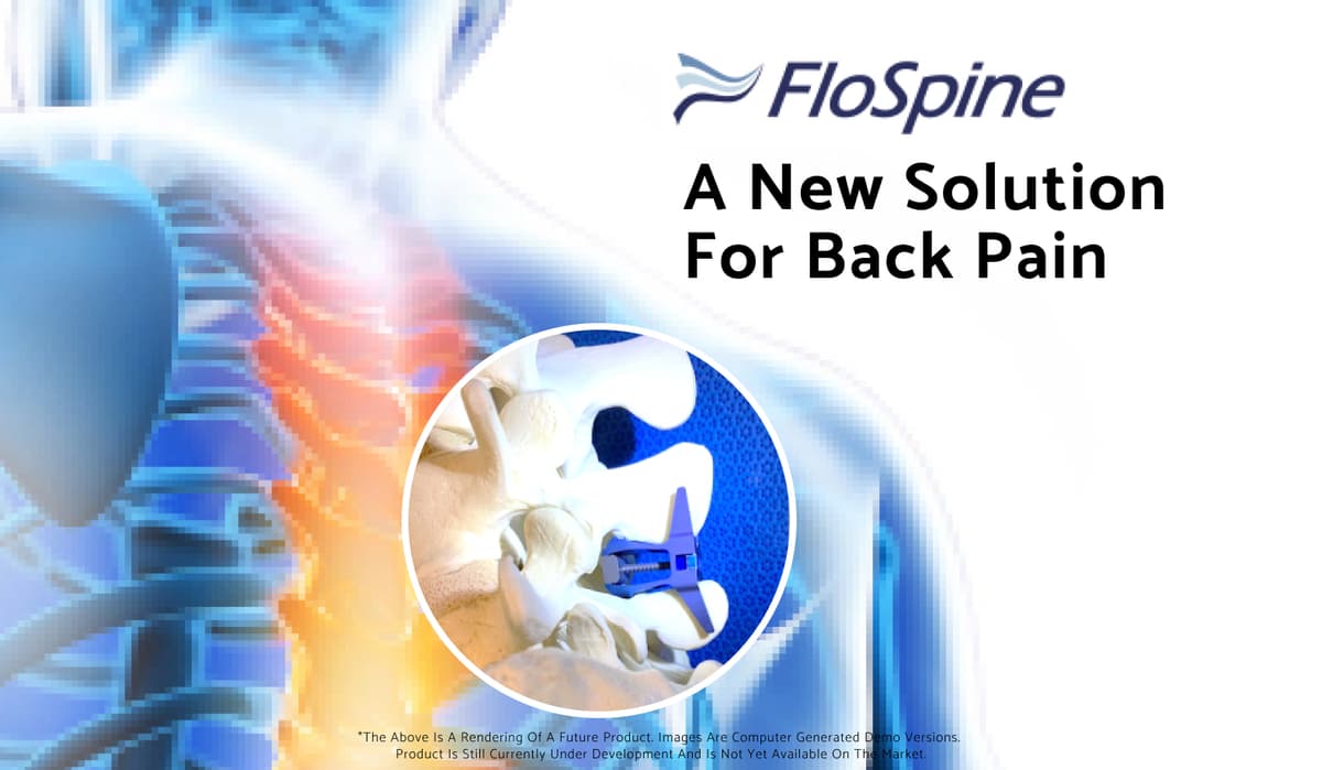 FloSpine cover image